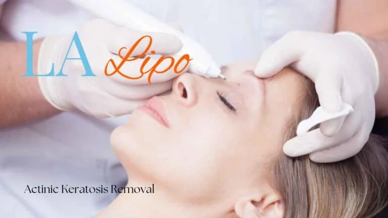 Woman receiving Actinic Keratosis Removal Treatment Bovingdon