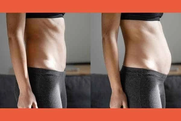 LA-EMS Body Sculpting results Bovingdon