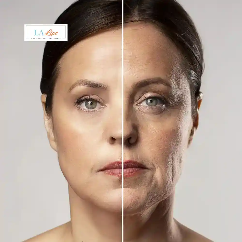 How Can You Tell If Non-Surgical Skin Tightening Is Right for You Bovingdon?