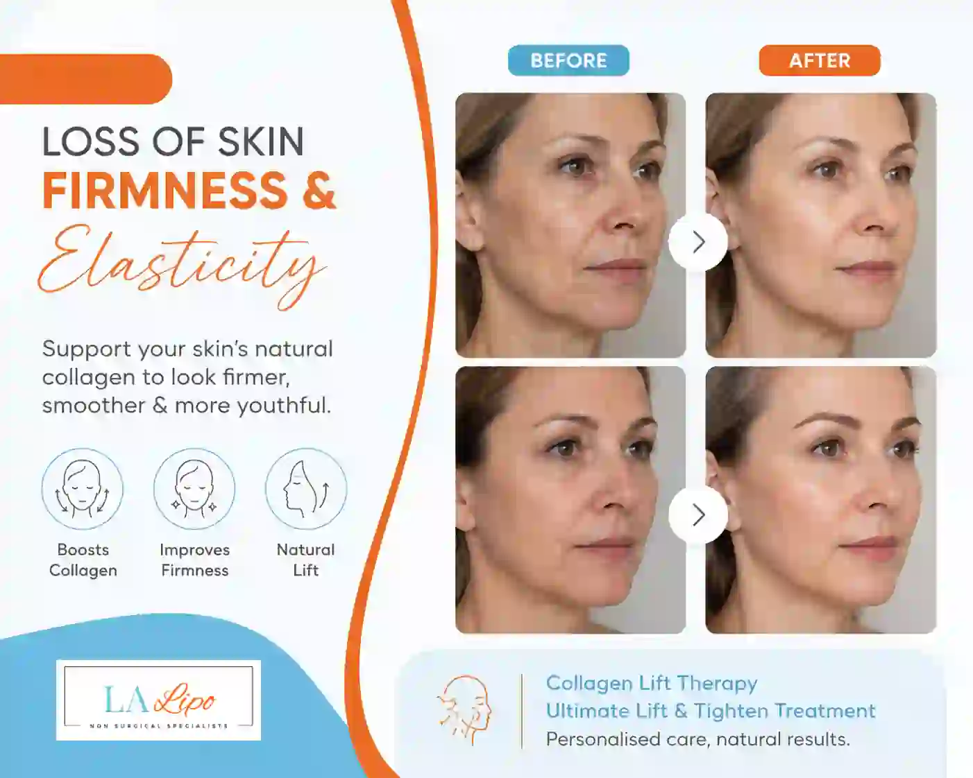 Sign #7: Loss of Skin Firmness and Elasticity Bovingdon