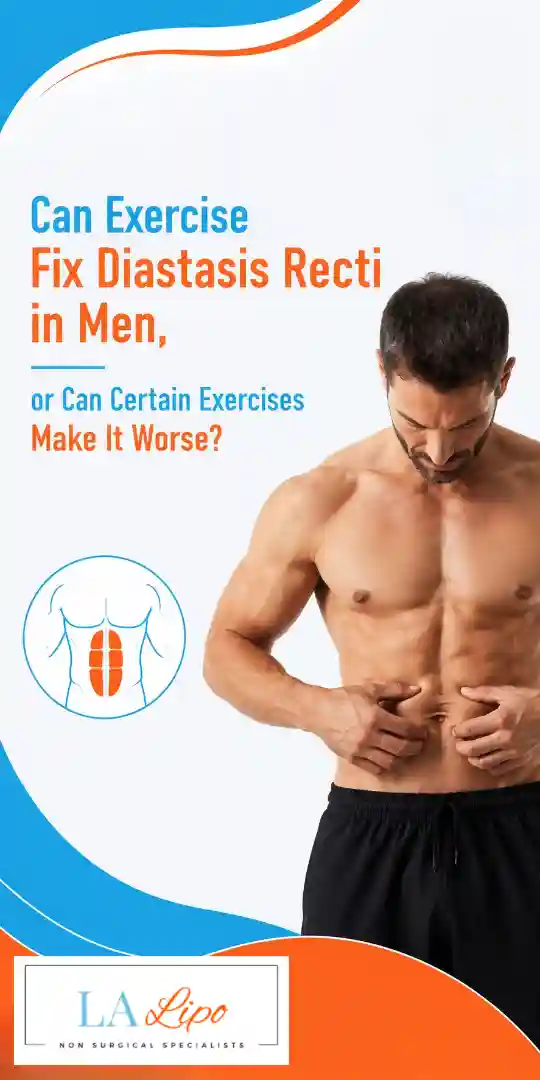 Can Exercise Fix Diastasis Recti in Men, or Can Certain Exercises Make It Worse Bovingdon?